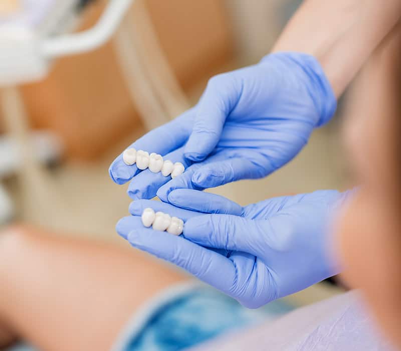 dental crowns in yaletown