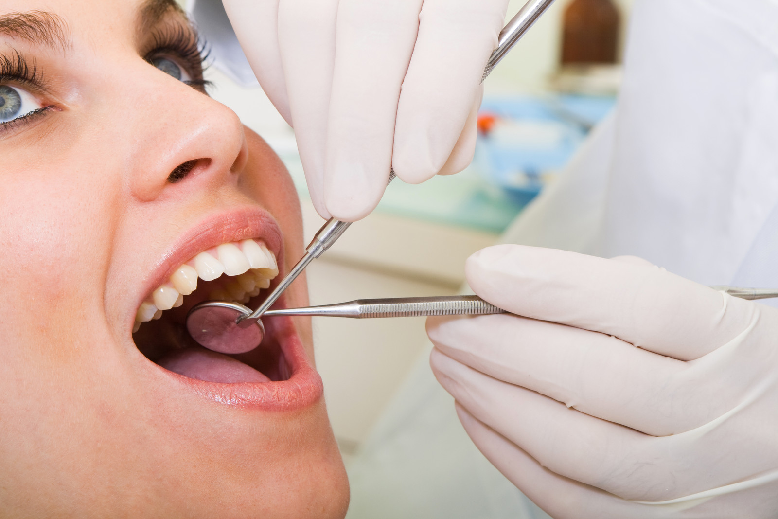 what you need to know about teeth cleaning