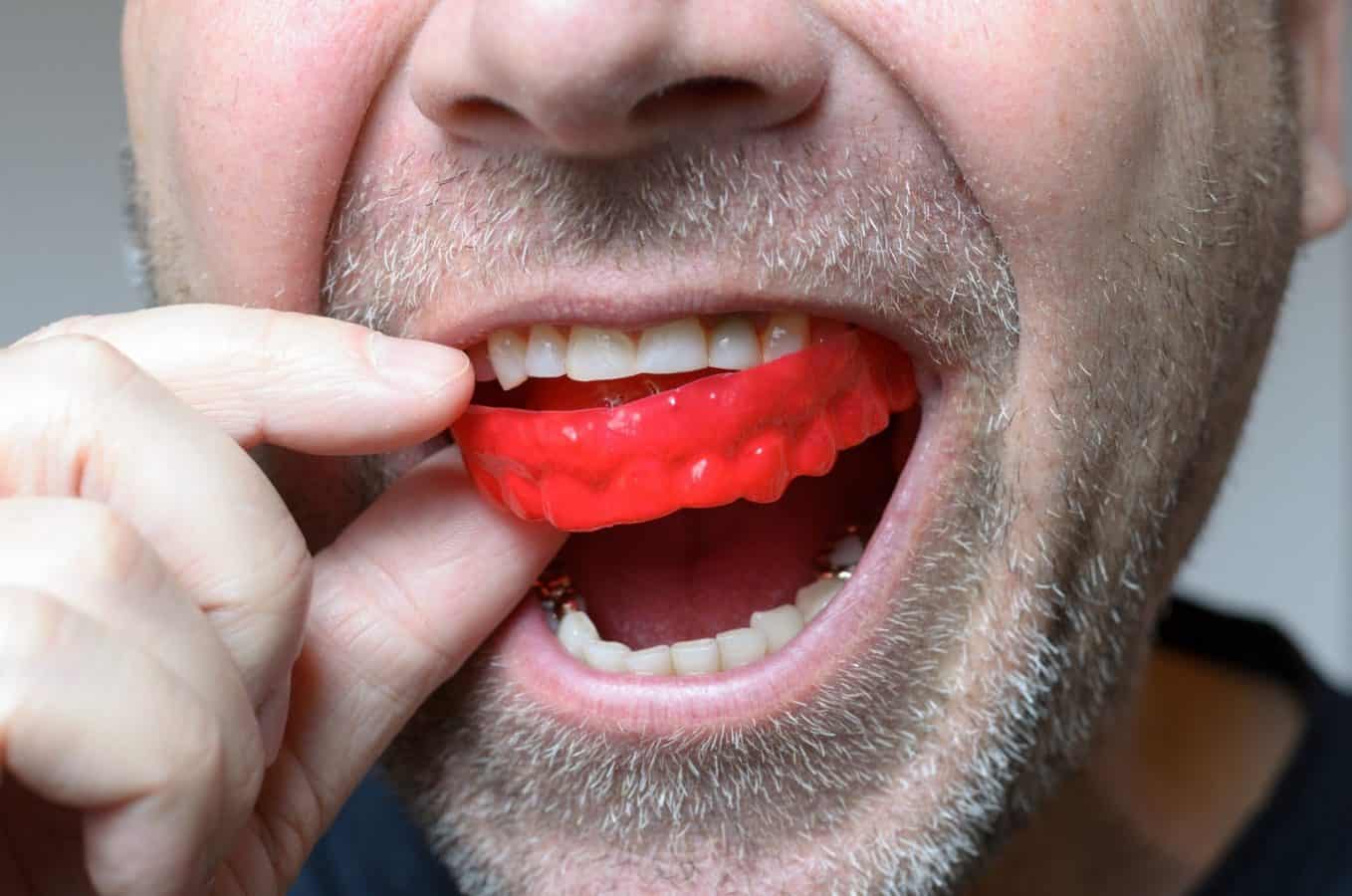 Sports Mouth Guards Are Mandatory Equipment Abba Dental