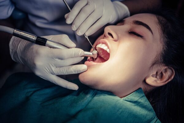 dental bonding for sensitive teeth