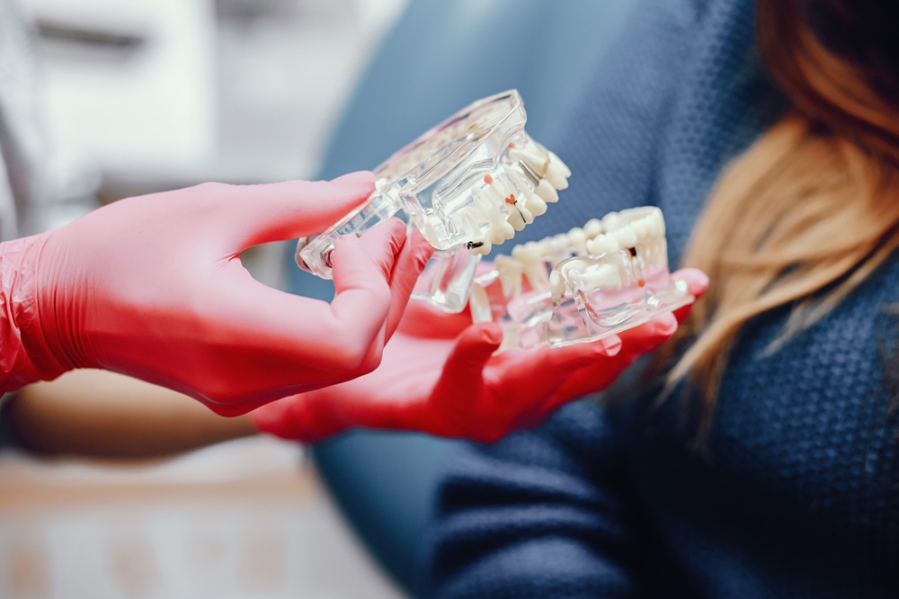 What Are the Steps Involved in Getting a Dental Bridge